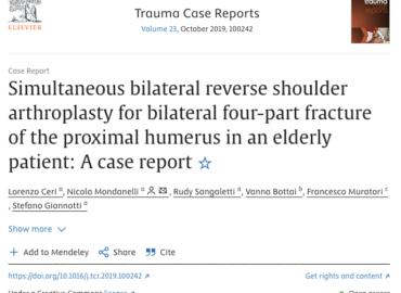 Artroplastica inversa bilaterale simultanea della spalla