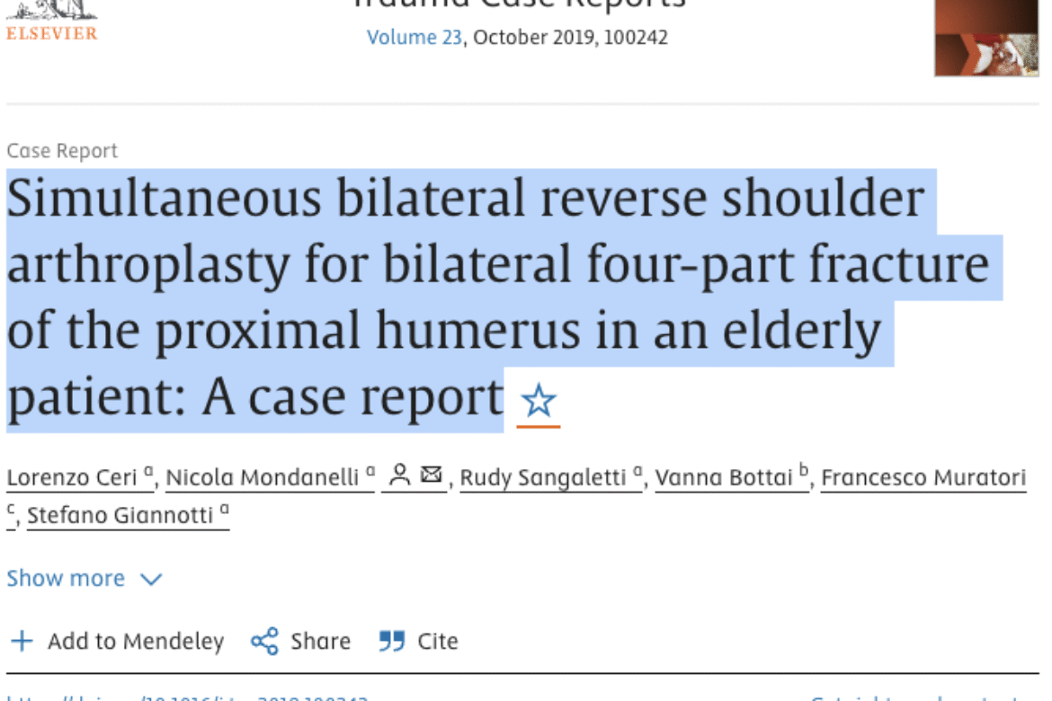 Procedura simultanea di artroplastica inversa bilaterale della spalla. Case Study