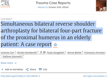 Procedura simultanea di artroplastica inversa bilaterale della spalla. Case Study